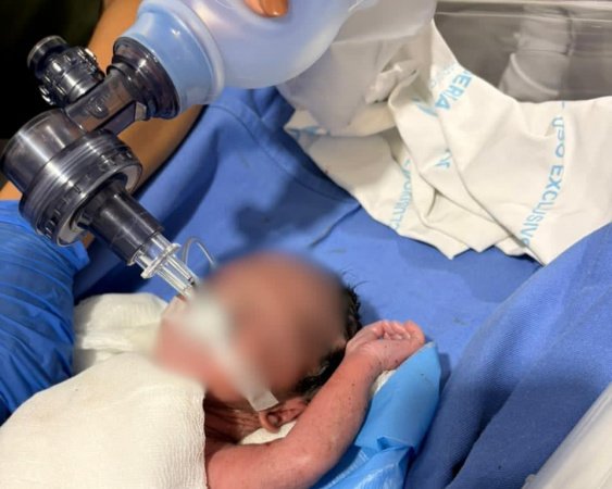 Resgate com Arcanjo 01 salva recém-nascido em parada cardiorrespiratória no Litoral