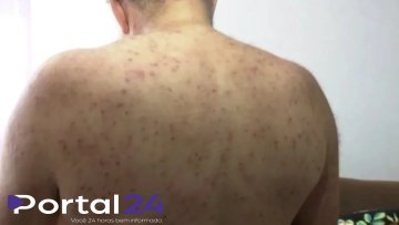 Aposentado sobrevive após ataque de enxame com mil picadas de abelha em Ponta Grossa