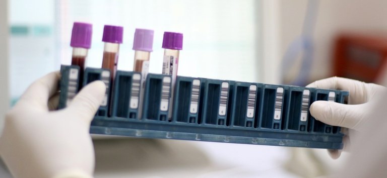 Paraná já conta com pontos de coleta para exame genético de doenças raras no SUS