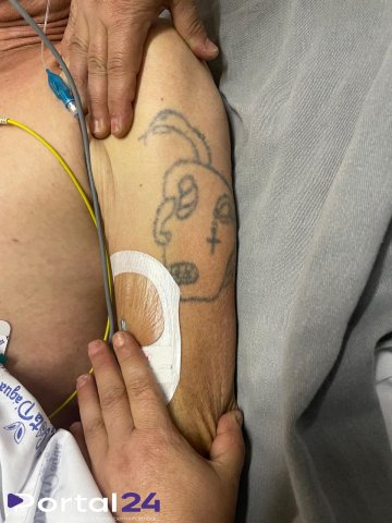 HUOP pede ajuda para identificar homem internado após atropelamento em Cascavel