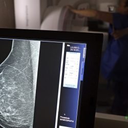 Outubro Rosa: como receber o auxílio-doença em tratamento
