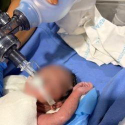 Resgate com Arcanjo 01 salva recém-nascido em parada cardiorrespiratória no Litoral