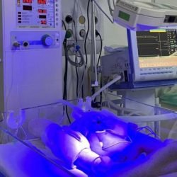 Hospitais públicos do Estado implantam primeiras unidades de UTI Neonatal Neurológica