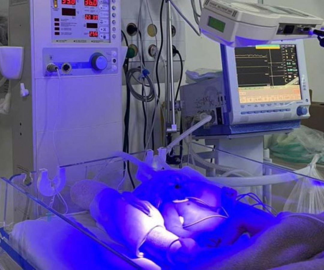 Hospitais públicos do Estado implantam primeiras unidades de UTI Neonatal Neurológica