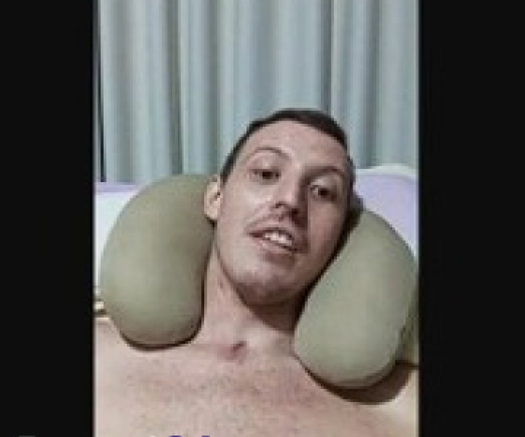 Atleta tetraplégico apresenta primeiros movimentos após aplicação inédita de polilaminina em Foz do Iguaçu