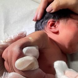 Paraná amplia vacinação da BCG em maternidades e protege bebês contra a tuberculose