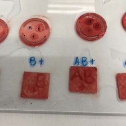 Apoio do Estado: curativo que identifica tipo sanguíneo em minutos passa por testes finais
