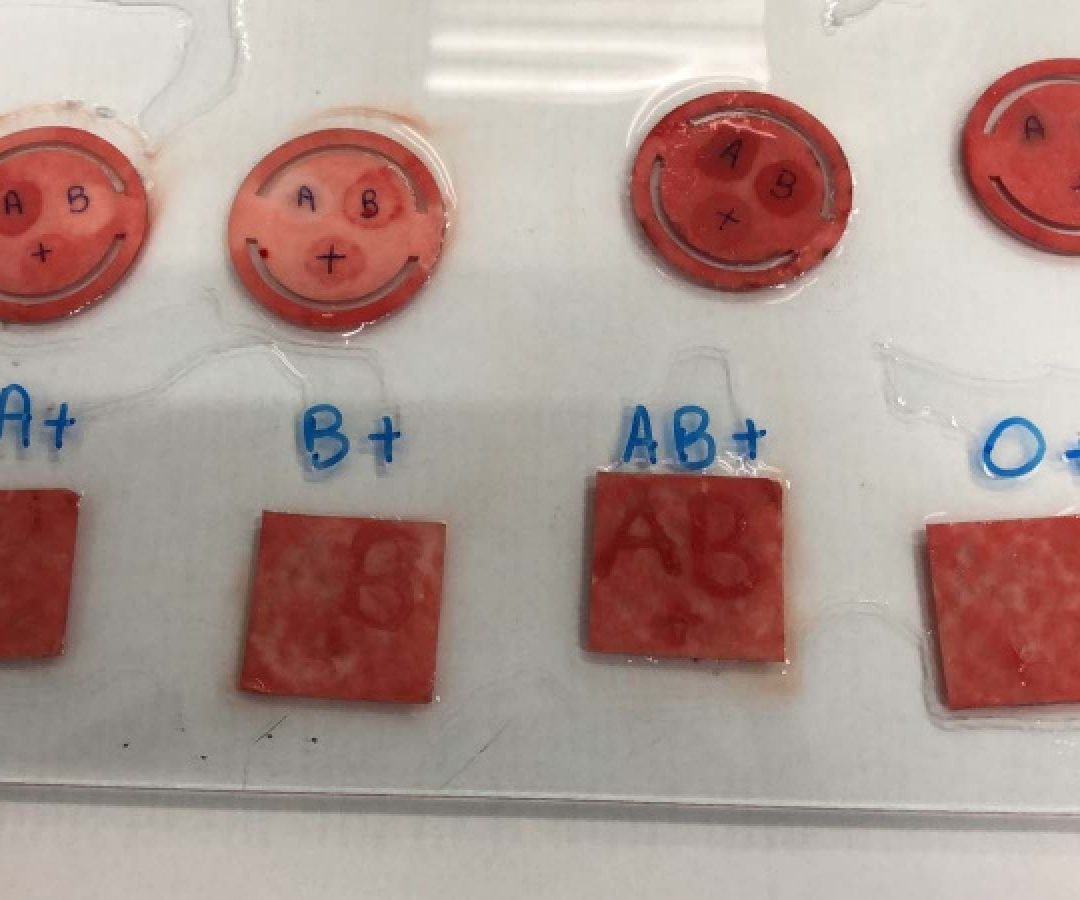 Apoio do Estado: curativo que identifica tipo sanguíneo em minutos passa por testes finais
