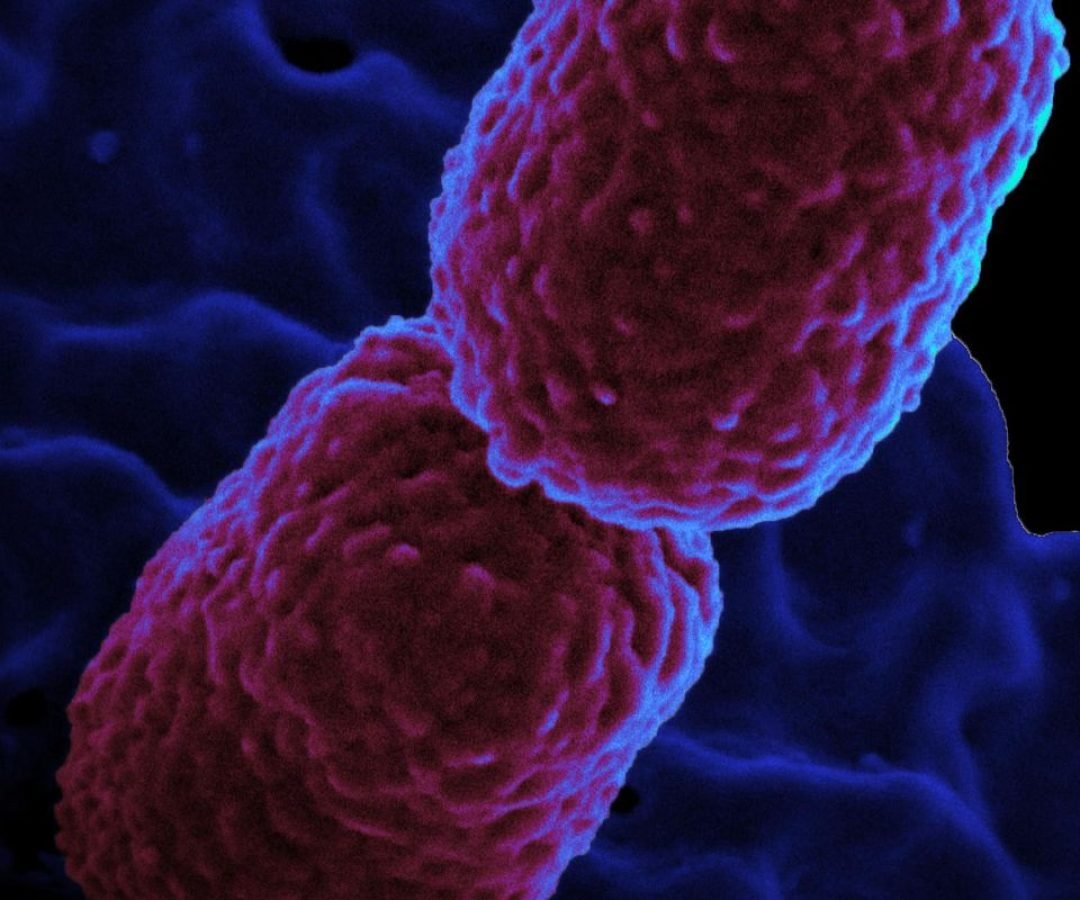 Hospital em Campinas restringe atendimento para conter superbactéria