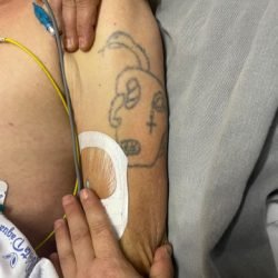 HUOP pede ajuda para identificar homem internado após atropelamento em Cascavel