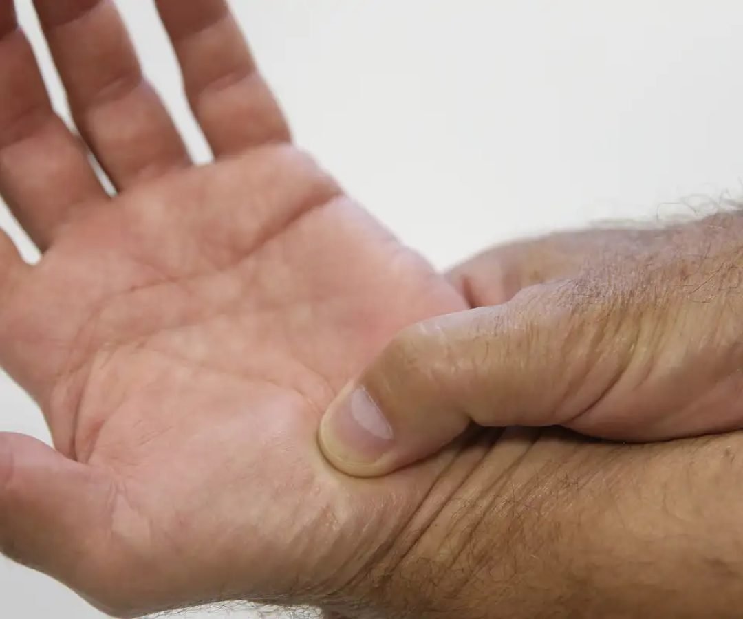 Novas diretrizes ampliam o tratamento de fibromialgia pelo SUS