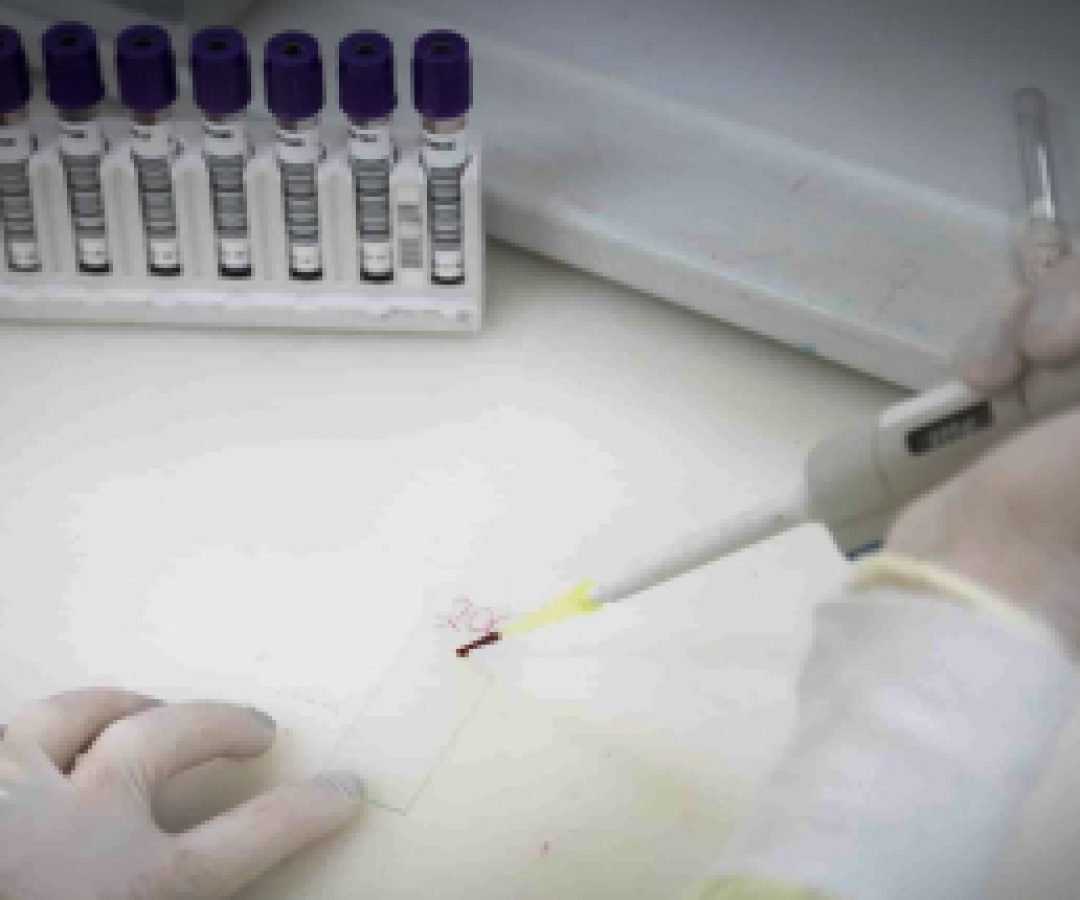 Paciente em SP com suspeita de ebola testa positivo para meningite
