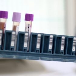 Paraná já conta com pontos de coleta para exame genético de doenças raras no SUS