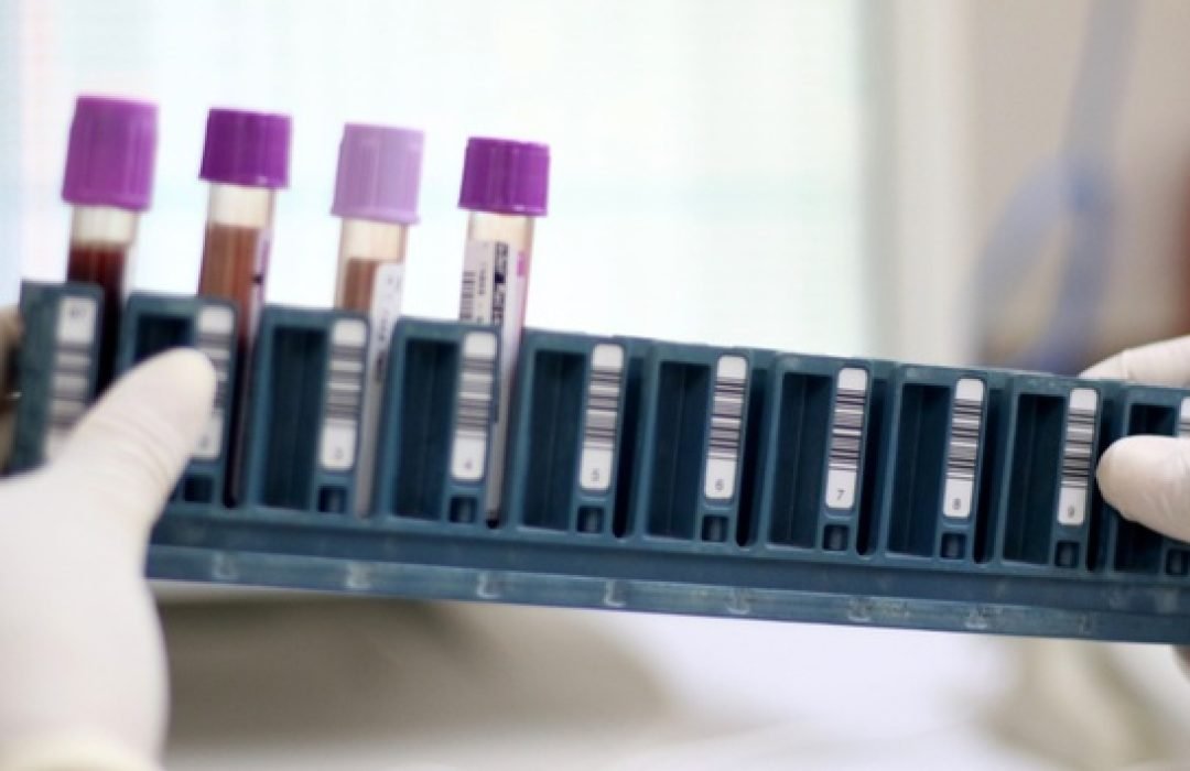 Paraná já conta com pontos de coleta para exame genético de doenças raras no SUS