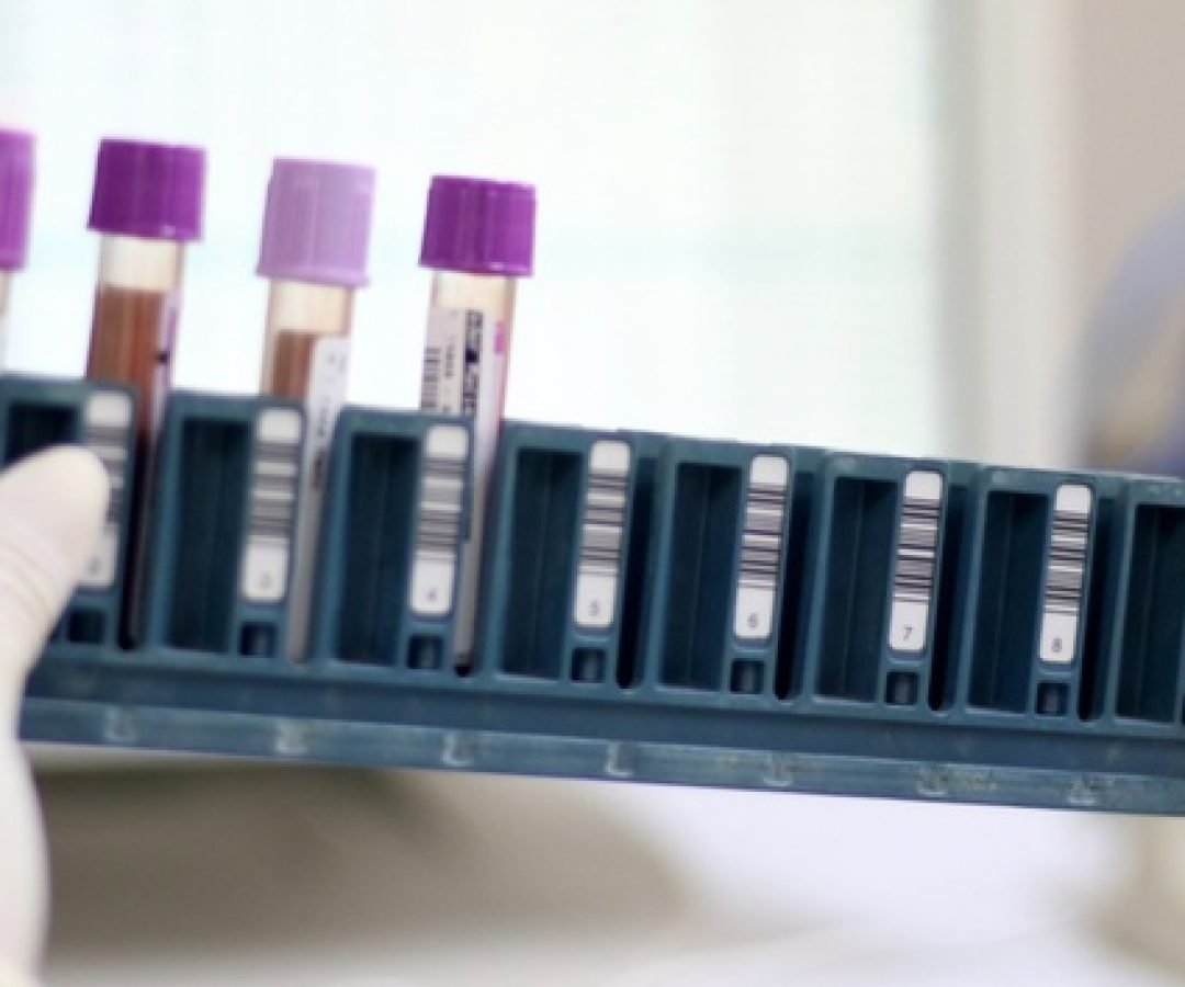 Paraná já conta com pontos de coleta para exame genético de doenças raras no SUS