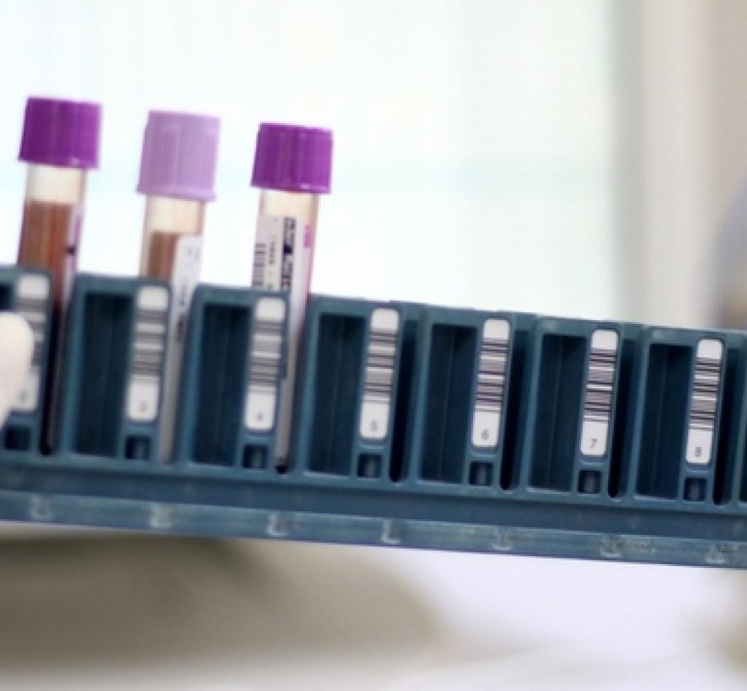 Paraná já conta com pontos de coleta para exame genético de doenças raras no SUS