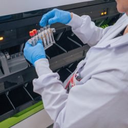 Hemepar passa a fazer testes sorológicos para aumentar segurança em transplantes