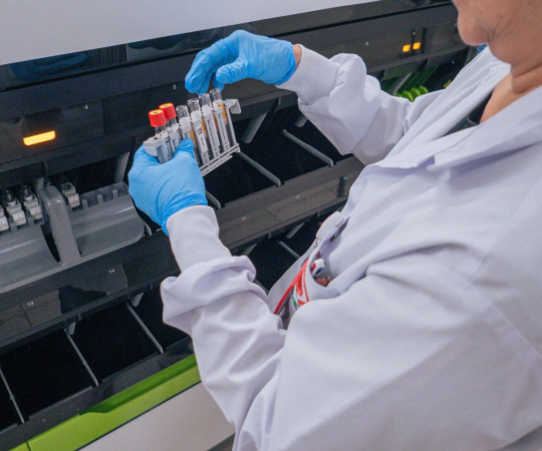 Hemepar passa a fazer testes sorológicos para aumentar segurança em transplantes