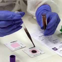Tecnologia da Polícia Científica reduz emissão de perfil genético de dias para poucas horas